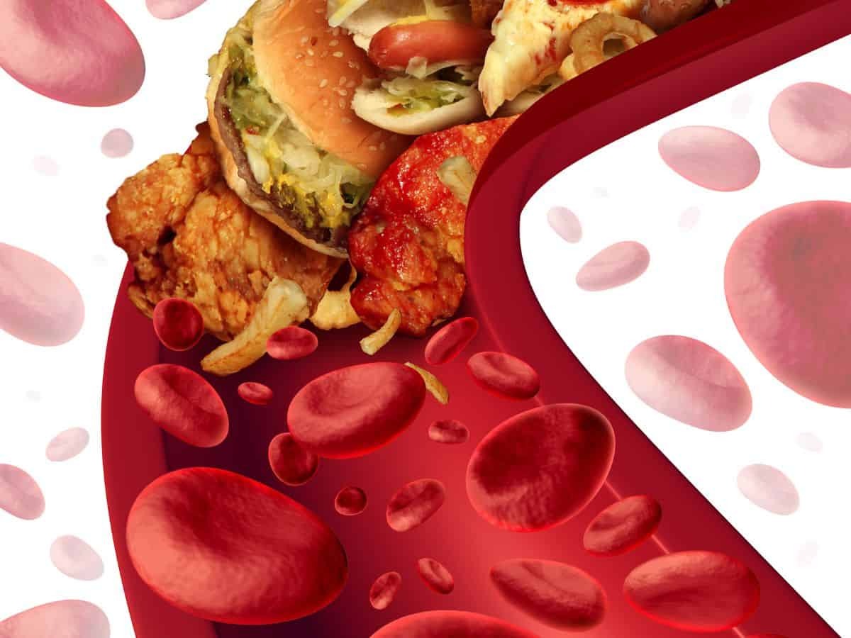 Cholesterol: Friend or Foe from a Functional Medicine Perspective?