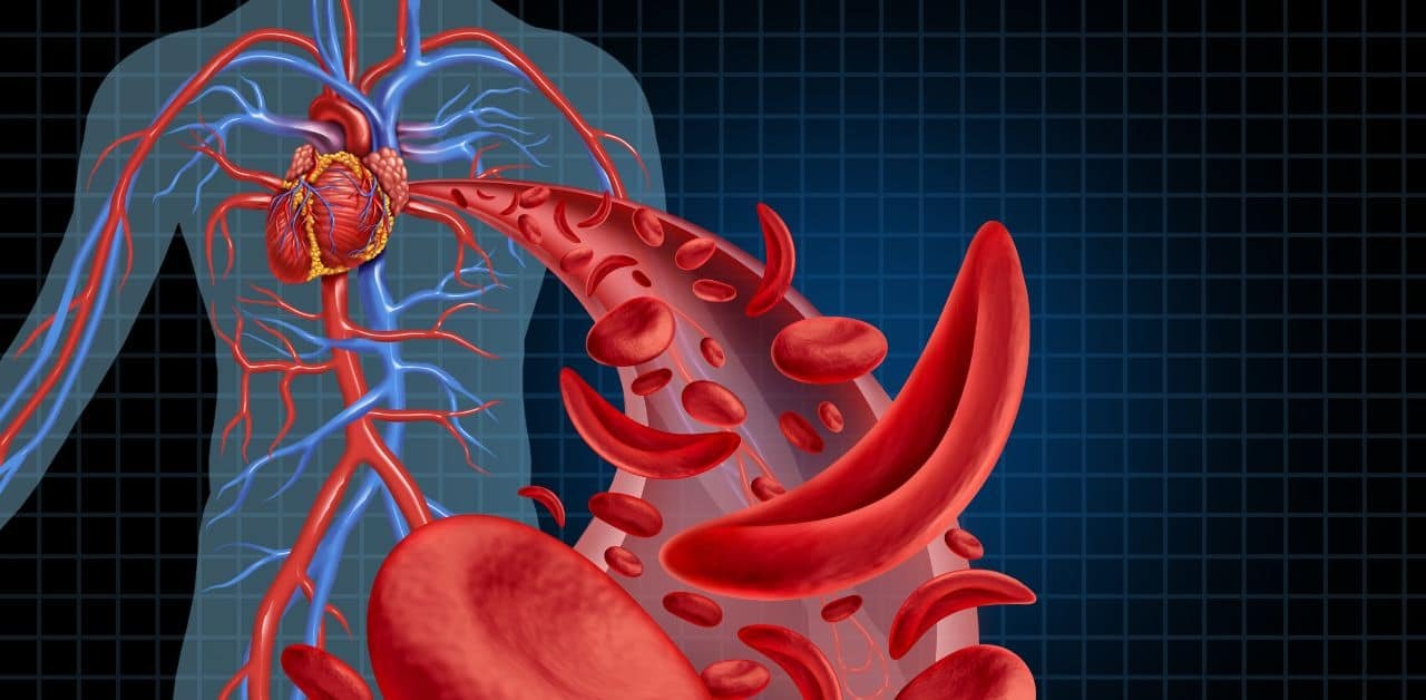 Cardiometabolic Health: Connecting Heart Health to Metabolic Dysfunction