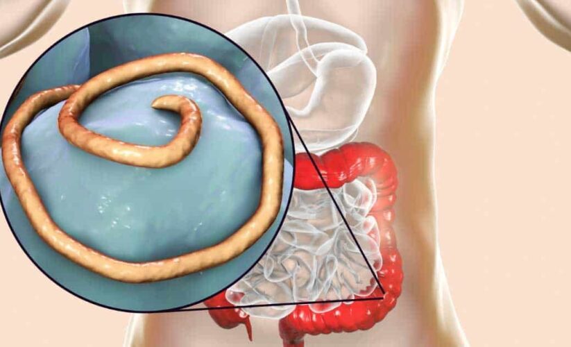 Are Intestinal Parasites causing your gut issues?
