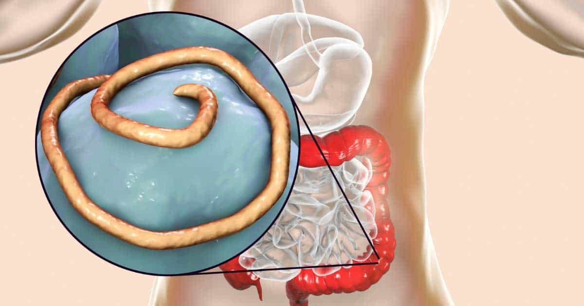 Are Intestinal Parasites causing your gut issues?